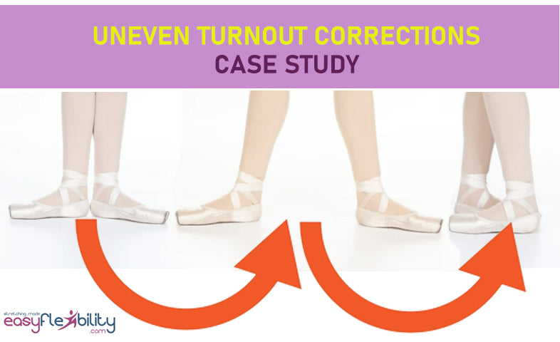 Dancers! Is your uneven turnout causing you pain, injuries, and decreased performance?
