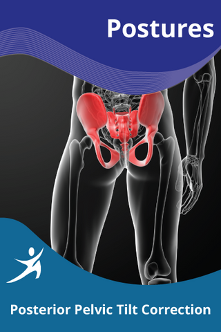 Posterior Pelvic Tilt Correction